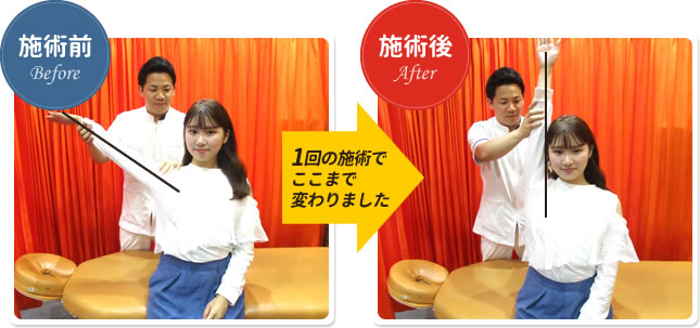 1回の施術でここまで変わりました